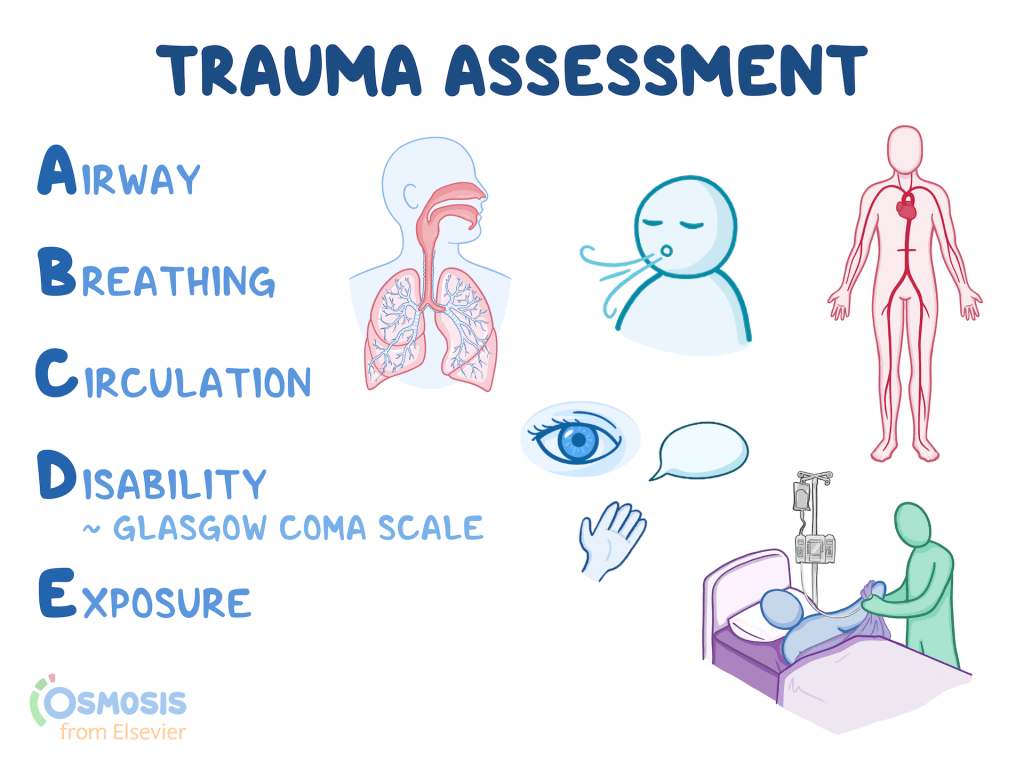 Educational graphic on trauma assessment using the ABCDE approach: Airway, Breathing, Circulation, Disability (Glasgow Coma Scale), and Exposure. It includes illustrations of the airway and lungs, breathing, circulation through the body, neurological assessment, and a patient being examined in a hospital bed.