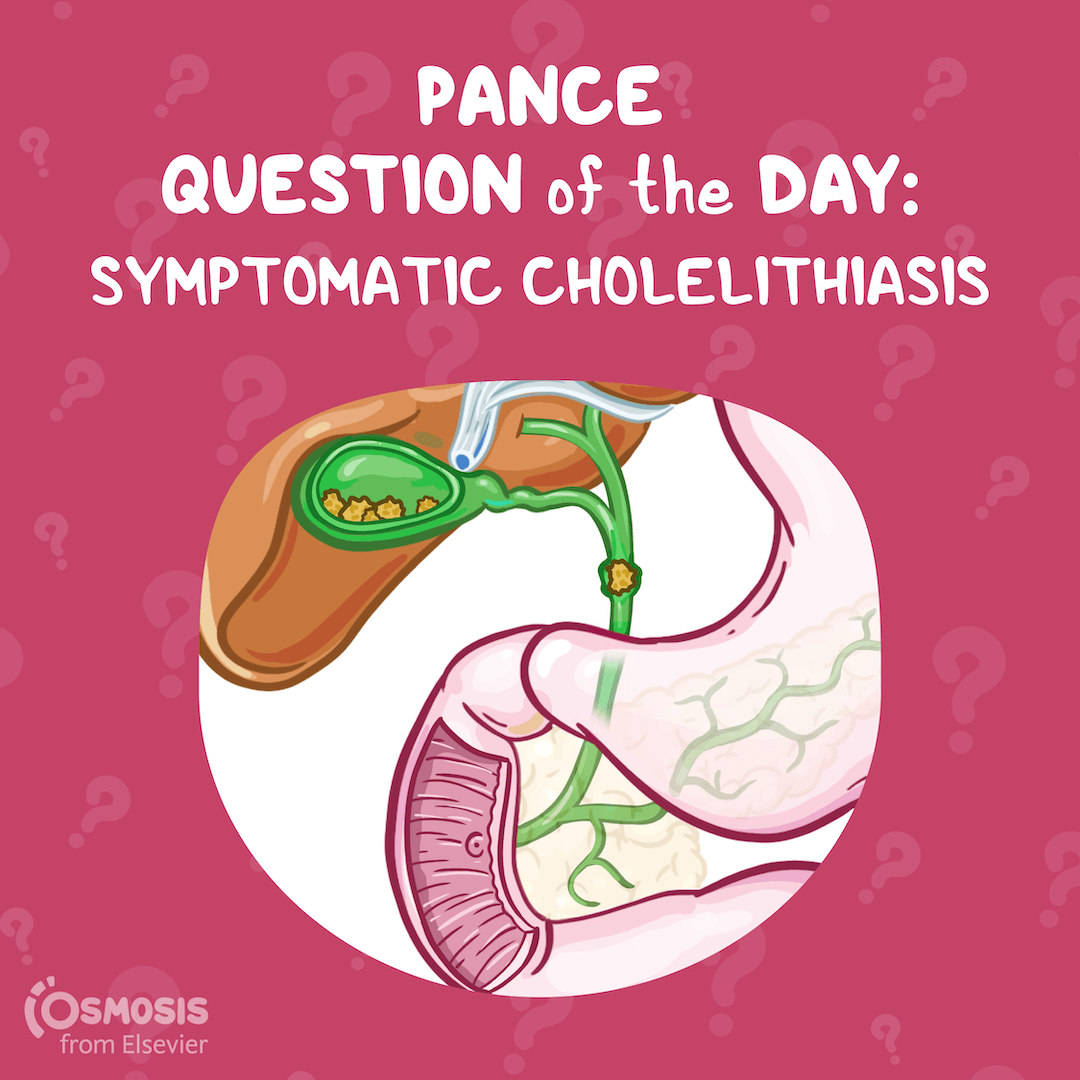 PANCE Question of the Day: Symptomatic Cholelithiasis