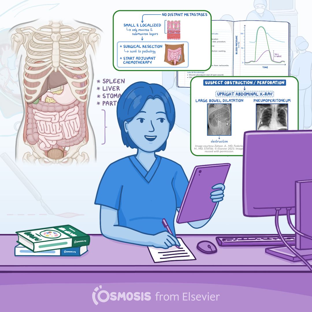 Surgery Shelf Exam: How to Study Less and Score Better