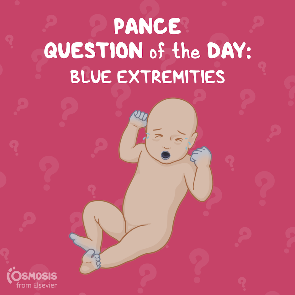 PANCE® Question of the Day: Blue extremities