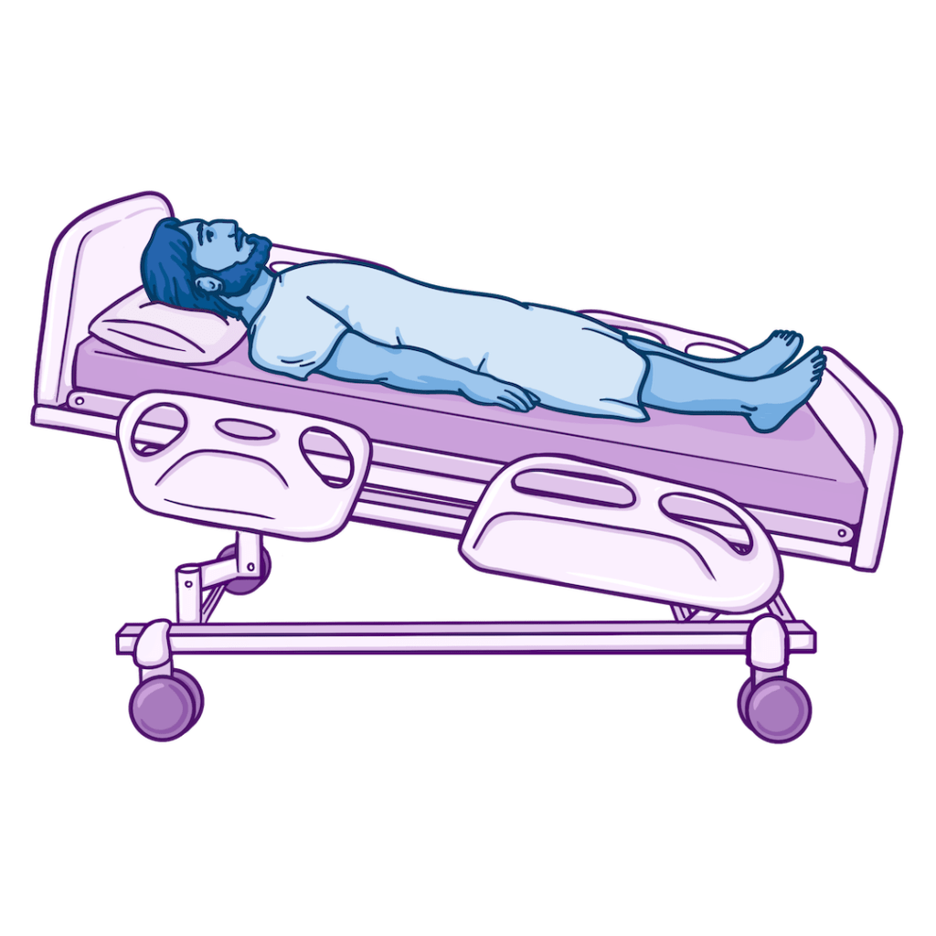 Illustration of a person lying on their back on a hospital bed with the head elevated and feet lowered, representing the reverse Trendelenburg position.