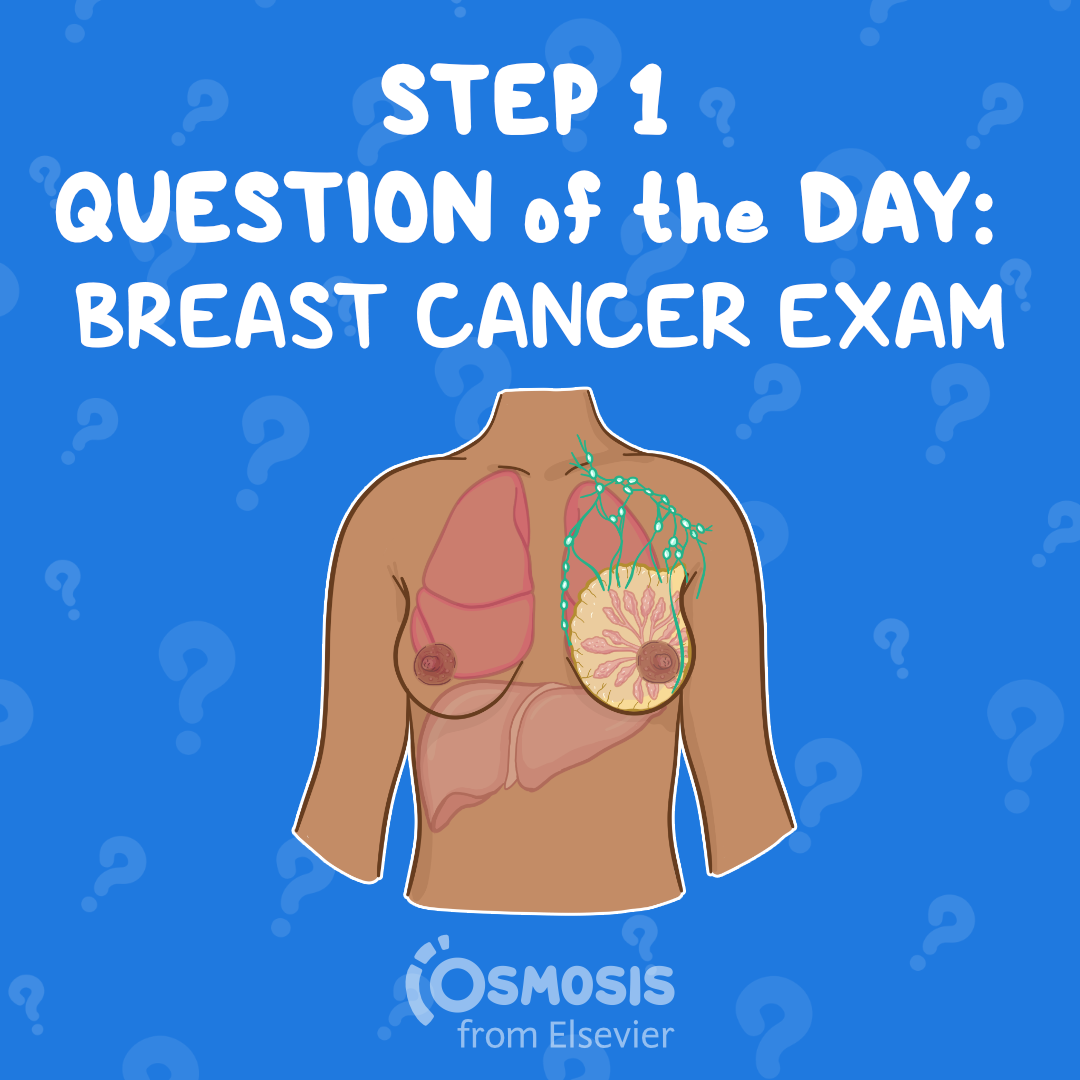 USMLE® Step 1 Question of the Day: Breast cancer exam