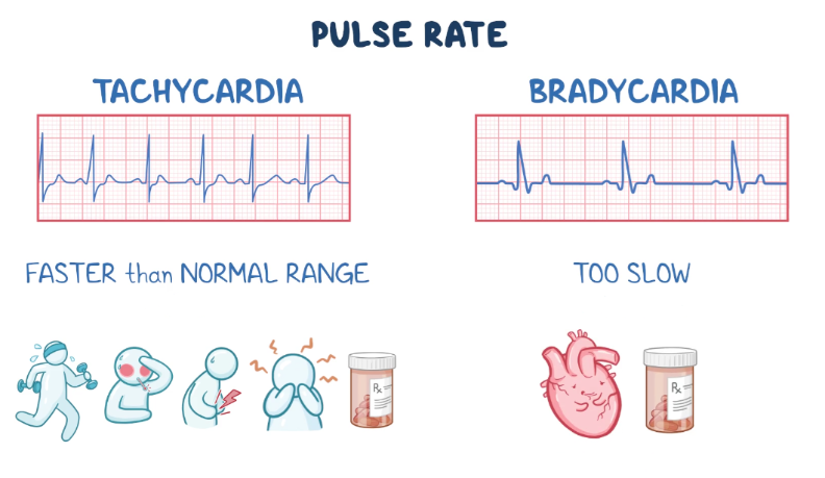 Osmosis nursing graphic comparing tachycardia and bradycardia. Electrocardiogram (ECG) tracings illustrate tachycardia as a heart rate faster than the normal range and bradycardia as a heart rate that is too slow. Icons beneath tachycardia depict possible associated conditions such as exercise, fever, pain, anxiety, and medication use, while icons beneath bradycardia show a heart and medication bottle representing causes of a slowed heart rate.