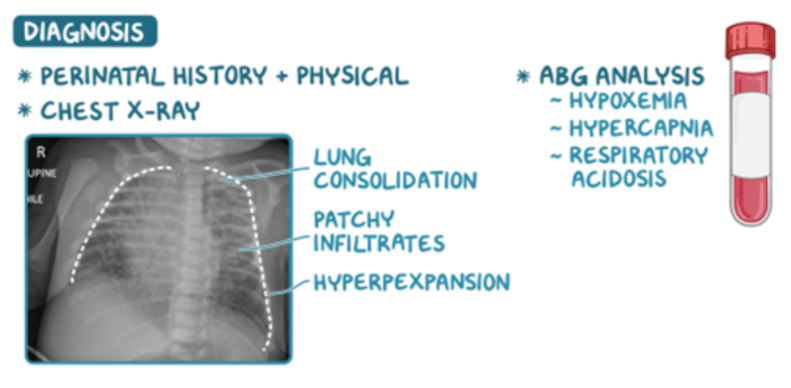 Osmosis.org educational graphic describing diagnostic evaluation for a respiratory condition. It highlights perinatal history, physical examination, chest X-ray findings, and arterial blood gas (ABG) analysis. The chest X-ray is labeled with lung consolidation, patchy infiltrates, and hyperexpansion, while the ABG section lists hypoxemia, hypercapnia, and respiratory acidosis as key findings. A blood sample tube is shown to represent laboratory testing.