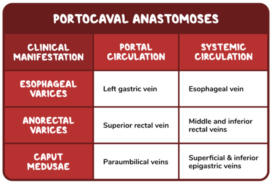 Table titled “Portocaval Anastomoses” showing connections between the portal and systemic venous circulations and their associated clinical manifestations. It lists esophageal varices (left gastric vein to esophageal veins), anorectal varices (superior rectal vein to middle and inferior rectal veins), and caput medusae (paraumbilical veins to superficial and inferior epigastric veins).