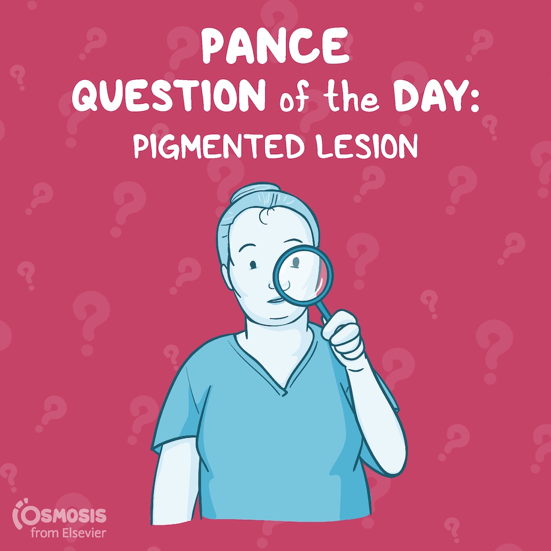 PANCE® Question of the Day: Pigmented lesion