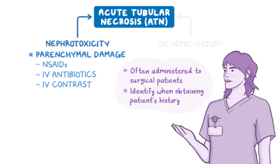 Educational graphic on acute tubular necrosis (ATN) highlighting nephrotoxicity as a cause of kidney injury. It lists nephrotoxic agents—including NSAIDs, intravenous antibiotics, and intravenous contrast—as causes of parenchymal damage. A healthcare professional reminds viewers that these medications are commonly given to surgical patients and should be identified when obtaining a patient's medication history.