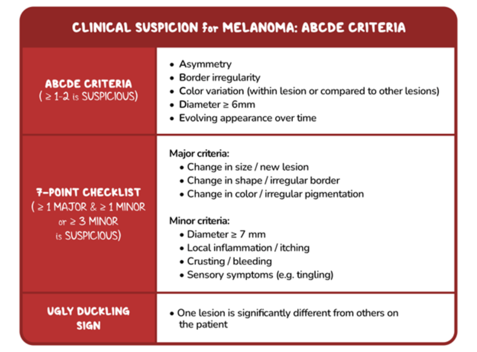 Table summarizing clinical features that raise suspicion for melanoma. It outlines the ABCDE criteria—asymmetry, border irregularity, color variation, diameter of 6 mm or greater, and evolution over time—and includes a 7-point checklist of major and minor warning signs such as changes in size, shape, or color, itching, bleeding, and sensory symptoms. The table also highlights the "ugly duckling" sign, where one skin lesion appears noticeably different from the patient's other moles.