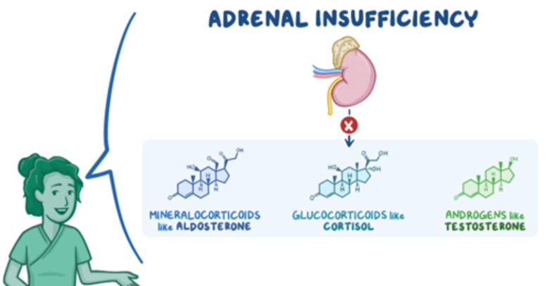 Educational graphic illustrating adrenal insufficiency. A diagram of the adrenal gland above the kidney is shown with reduced hormone production, highlighting decreased mineralocorticoids (such as aldosterone), glucocorticoids (such as cortisol), and adrenal androgens (such as testosterone). A healthcare professional is shown speaking alongside the diagram, indicating an educational explanation of the condition.