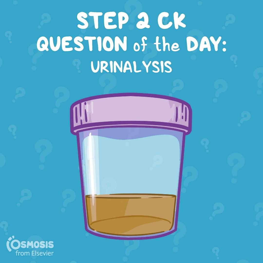 USMLE® Step 2 CK Question of the Day: Urinalysis