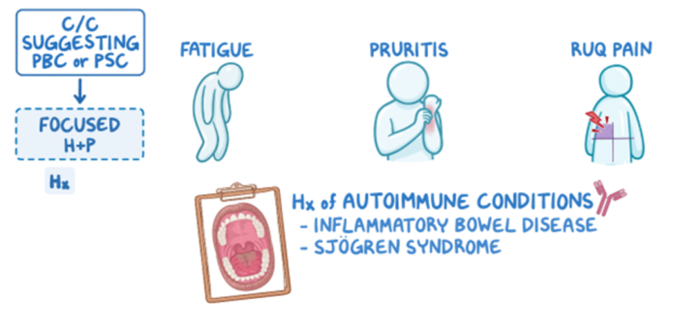 Osmosis.org educational illustration showing clinical features that may suggest primary biliary cholangitis (PBC) or primary sclerosing cholangitis (PSC) and prompt a focused history and physical examination. Key findings include fatigue, pruritus, right upper quadrant abdominal pain, and a history of autoimmune conditions such as inflammatory bowel disease or Sjögren syndrome.