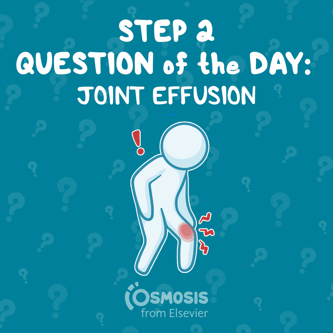 USMLE® Step 2 CK Question of the Day: Joint effusion