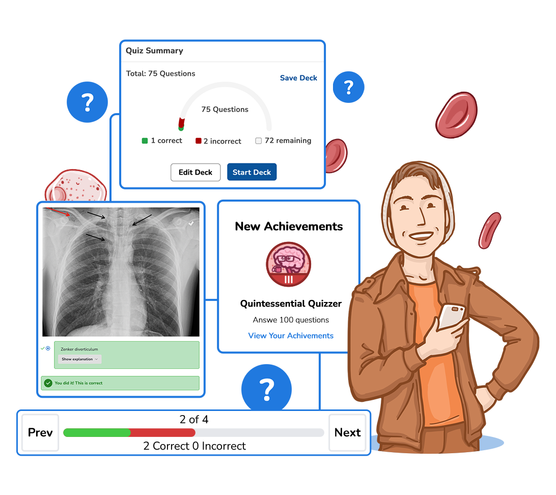 Osmosis Quiz Builder interface showing a chest X-ray Zenker diverticulum question, 75-question quiz summary dashboard, and a new Quintessential Quizzer achievement badge for answering 100 questions.
