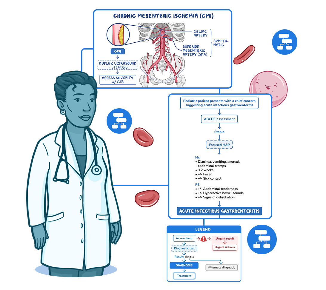 Osmosis clinical decision tree flowcharts for chronic mesenteric ischemia with duplex ultrasound pathway and acute infectious gastroenteritis ABCDE assessment, presented by a female physician in a white coat.