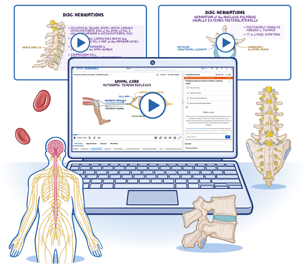 Osmosis.org style illustration of a laptop displaying a spinal cord autonomic tendon reflex lesson, surrounded by educational videos and anatomical illustrations of disc herniation, the spine, spinal nerves, and vertebral discs.